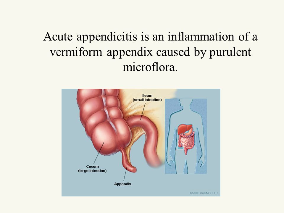 Bforex appendicitis dukascopy jforex android tablet